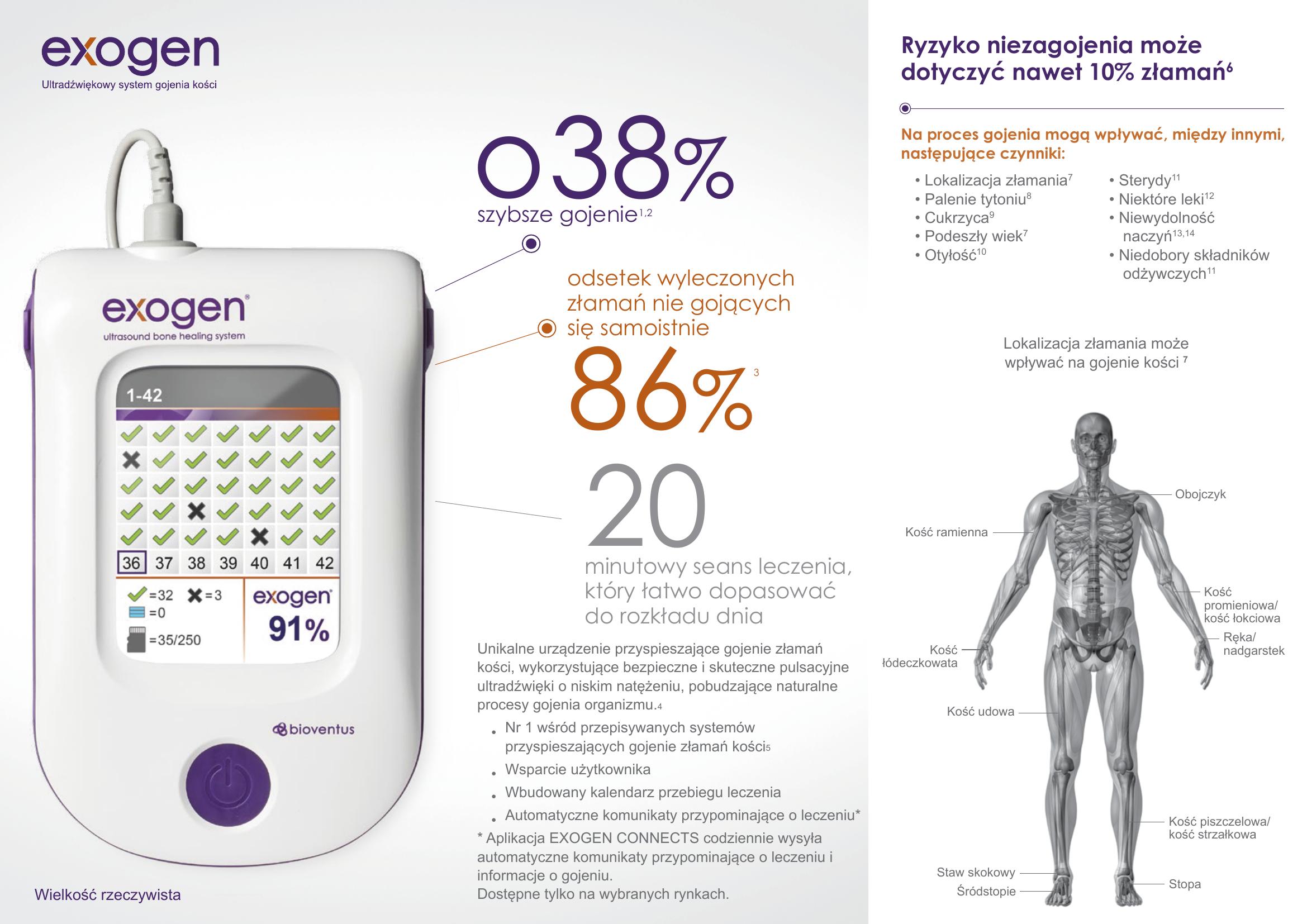 Informacje o systemie Exogen — 38% szybsze gojenie, 86% wyleczonych zrostów oraz lokalizacje złamań